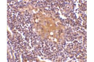 Image no. 2 for anti-CD5 Molecule-Like (CD5L) (C-Term) antibody (ABIN318735) (CD5L Antikörper  (C-Term))