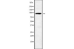 ARHGAP12 Antikörper  (Internal Region)