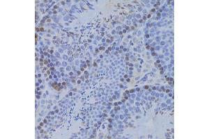Immunohistochemistry of paraffin-embedded mouse testis using JMJD6 Antibody (ABIN5973452) at dilution of 1/100 (40x lens). (JMJD6 Antikörper)