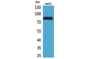 Western Blotting (WB) image for anti-CD248 Molecule, Endosialin (CD248) (Internal Region) antibody (ABIN3178297) (CD248 Antikörper  (Internal Region))