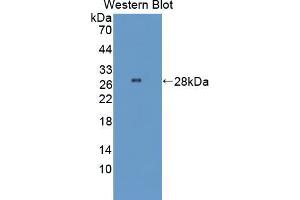 Western blot analysis of the recombinant protein. (STING/TMEM173 Antikörper  (AA 160-371))