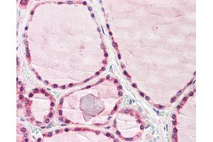 Anti-Adenylate Cyclase 6 / ADCY6 antibody IHC of human thyroid. (ADCY6 Antikörper  (AA 794-843))