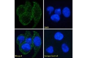 Immunofluorescence staining of fixed A549 cells with anti-EDAR antibody EDAR12. (Rekombinanter EDAR Antikörper)