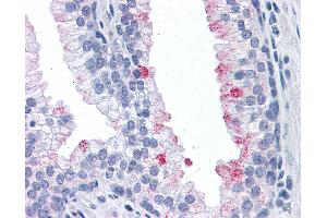 Anti-RTKN antibody IHC of human prostate. (Rhotekin Antikörper  (AA 451-550))