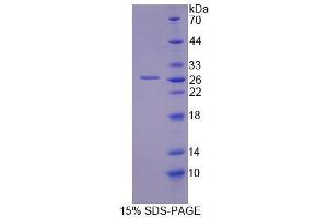 SDS-PAGE analysis of Mouse GFM2 Protein. (GFM2 Protein)