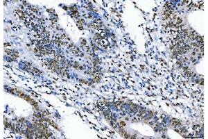 IHC analysis of TLS/FUS using anti-TLS/FUS antibody (ABIN7603099).