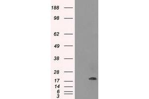 HEK293T cells were transfected with the pCMV6-ENTRY control (Left lane) or pCMV6-ENTRY CRYAB (Right lane) cDNA for 48 hrs and lysed. (CRYAB Antikörper)