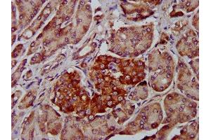 Immunohistochemistry (IHC) image for anti-ADAM Metallopeptidase Domain 8 (ADAM8) (AA 677-824) antibody (ABIN7150062)