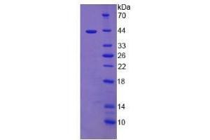 SDS-PAGE analysis of Human Cholecystokinin Protein. (Cholecystokinin Protein (CCK))