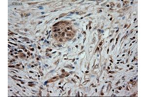 Immunohistochemical staining of paraffin-embedded kidney using anti-NTF3 (ABIN2452683) mouse monoclonal antibody. (Neurotrophin 3 Antikörper  (AA 139-257))