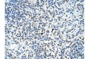 ZMYND11 antibody was used for immunohistochemistry at a concentration of 4-8 ug/ml to stain Spleen cells (arrows) in Human Spleen. (ZMYND11 Antikörper  (Middle Region))