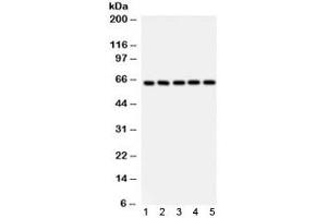 Western blot testing of 1) rat thymus, 2) mouse testis, human 3) Jurkat, 4) K562 and 5) HeLa lysate using SHC antibody.