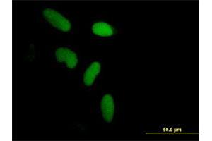 Immunofluorescence of purified MaxPab antibody to ZNF433 on HeLa cell. (ZNF433 Antikörper  (AA 1-638))