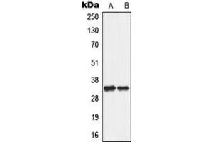 Western blot analysis of ANT2 expression in A549 (A), PC12 (B) whole cell lysates. (SLC25A5 Antikörper  (Center))
