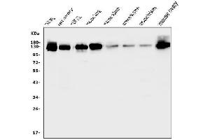 Western blot analysis of MCAM using anti-MCAM antibody (ABIN7601026).
