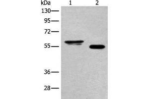 Western blot analysis of Human cervical cancer tissue and A549 cell lysates using HAS3 Polyclonal Antibody at dilution of 1:400 (HAS3 Antikörper)