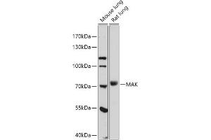 Western blot analysis of extracts of various cell lines, using MAK antibody (ABIN7268382) at 1:1000 dilution. (MAK Antikörper  (AA 370-435))