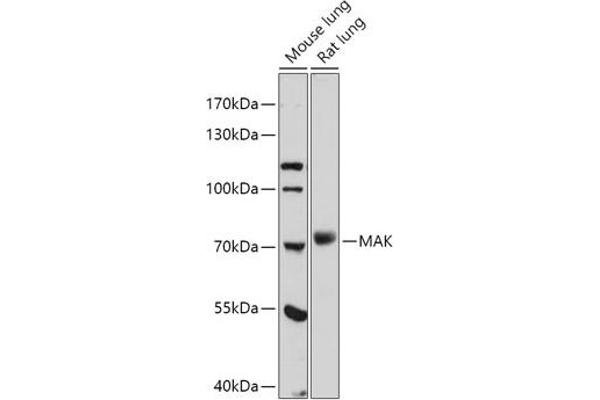 MAK 抗体  (AA 370-435)