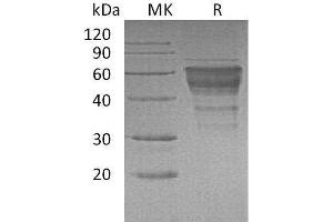 Western Blotting (WB) image for Hepatitis A Virus Cellular Receptor 2 (TIM 3) (Active) protein (Fc Tag) (ABIN7320774)