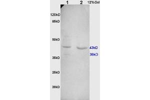 L1 rat kidney, L2 human colon carcinoma lysates probed (ABIN732098) at 1:200 in 4 °C.
