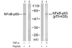 Image no. 2 for anti-Nuclear Factor-kB p65 (NFkBP65) (Thr435) antibody (ABIN197112) (NF-kB p65 Antikörper  (Thr435))