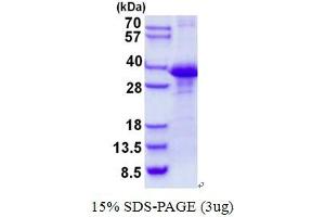 Image no. 1 for Chloride Channel, Nucleotide-Sensitive, 1A (CLNS1A) protein (His tag) (ABIN1098452)