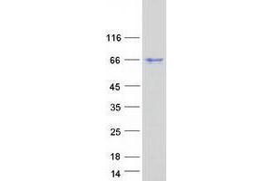 ZC3H15 Protein (Myc-DYKDDDDK Tag)