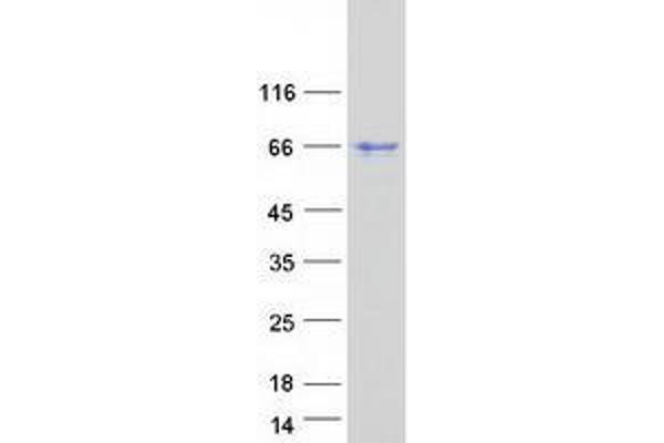 ZC3H15 Protein (Myc-DYKDDDDK Tag)