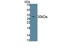Detection of Recombinant DRD2, Canine using Polyclonal Antibody to Dopamine Receptor D2 (DRD2) (Dopamine d2 Receptor Antikörper)