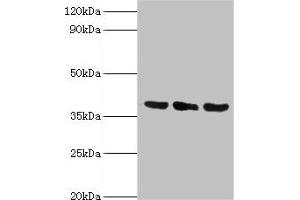 Western blot All lanes: TMOD3 antibody at 5 μg/mL Lane 1: Jurkat whole cell lysate Lane 2: MCF-7 whole cell lysate Lane 3: Hela whole cell lysate Secondary Goat polyclonal to rabbit IgG at 1/10000 dilution Predicted band size: 40 kDa Observed band size: 40 kDa (TMOD3 Antikörper  (AA 1-352))
