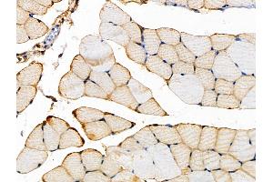 ABIN6262613 and ABIN6266565 at 1/100 staining Mouse muscle tissue by IHC-P. (Integrin beta 5 Antikörper  (C-Term))