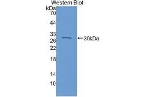 Western blot analysis of recombinant Mouse C1INH. (SERPING1 Antikörper  (AA 35-179))