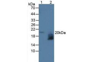 Figure. (WFDC2 Antikörper  (AA 30-124))