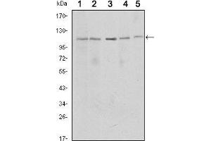 Western blot analysis using SIRT1 mouse mAb against MCF-7 (1), Jurkat (2), Hela (3), HEK293 (4) and A549 (5) cell lysate. (SIRT1 Antikörper)