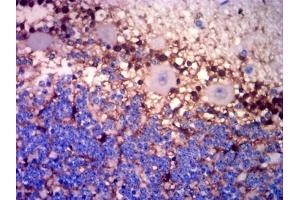 Immunohistochemistry (IHC) image for anti-Glutamate-Ammonia Ligase (GLUL) (AA 2-121) antibody (ABIN7193662)