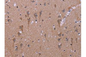 The image on the left is immunohistochemistry of paraffin-embedded Human brain tissue using ABIN7191187(KCNJ9 Antibody) at dilution 1/30, on the right is treated with synthetic peptide. (KCNJ9 Antikörper)