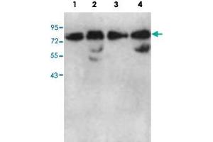 Western blot analysis of HeLa cell (Lane 1), human fetal kidney (Lane 2), K-562 cell (Lane 3) and fetal lung (Lane 4) lysate with AARSD1 polyclonal antibody  at 1 : 1000 dilution. (AARSD1 Antikörper  (AA 278-522))