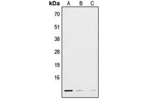 Western blot analysis of POLR3K expression in HepG2 (A), mouse lung (B), H9C2 (C) whole cell lysates. (POLR3K Antikörper  (Center))