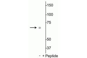 Western blot of Drosophila S2 cell lysate showing specific labeling of the ~70 kDa p70 S6K protein phosphorylated at Thr398 in the first lane (-). (RPS6KB1 Antikörper  (pThr398))