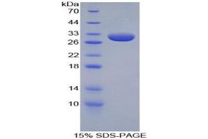 SDS-PAGE analysis of Rabbit Apolipoprotein A1 Protein.