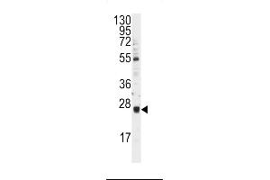 Western blot analysis of anti-UBCH9 Antibody (N-term) (ABIN388952 and ABIN2839206) in Y79 cell line lysates (35 μg/lane). (UBE2E3 Antikörper  (N-Term))