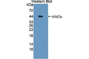 Detection of Recombinant GDN, Human using Polyclonal Antibody to Glia Derived Nexin (GDN)