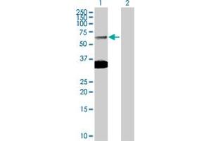 Western Blot analysis of SMAD6 expression in transfected 293T cell line by SMAD6 MaxPab polyclonal antibody.
