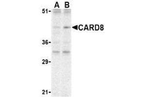 Western blot analysis of CARD8 expression in K562 cell lysate with AP30184PU-N CARD8 antibody at (A) 2 and (B) 4 μg /ml. (CARD8 Antikörper)