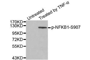 Western blot analysis of extract from HeLa cells, using phospho-NFKB1-S907 antibody (ABIN2988208). (NFKB1 Antikörper  (pSer907))