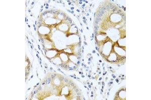 Immunohistochemistry of paraffin-embedded human colon using PRKCA antibody. (PKC alpha Antikörper  (C-Term))