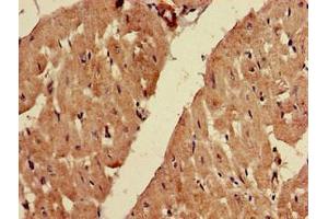 Immunohistochemistry of paraffin-embedded human heart tissue using ABIN7152606 at dilution of 1:100 (FADS1 Antikörper  (AA 1-121))
