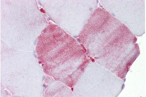 Immunohistochemistry (IHC) image for anti-Fatty Acid Binding Protein 3, Muscle and Heart (FABP3) (Middle Region) antibody (ABIN2782984)