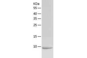 Western Blotting (WB) image for Calcium/calmodulin-Dependent Protein Kinase II Inhibitor 1 (CAMK2N1) (AA 1-78) protein (His tag) (ABIN7122093)