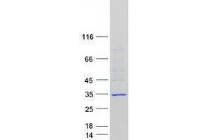 Western Blotting (WB) image for Folliculogenesis Specific Basic Helix-Loop-Helix (FIGLA) protein (Myc-DYKDDDDK Tag) (ABIN2721187)